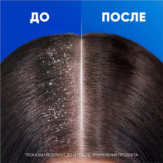 Шампунь-бальзам Head&Shoulders Ментол 2в1 360мл Румыния