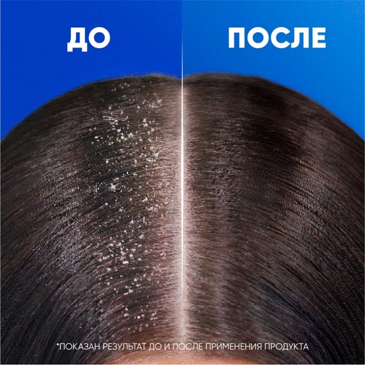 Шампунь Хэд&Шолдерс Густые и крепкие 360мл Procter&Gamble Румыния