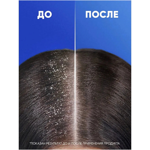 Шампунь Хэд&Шолдерс Энергия океана Против перхоти 360мл Procter&Gamble Румыния